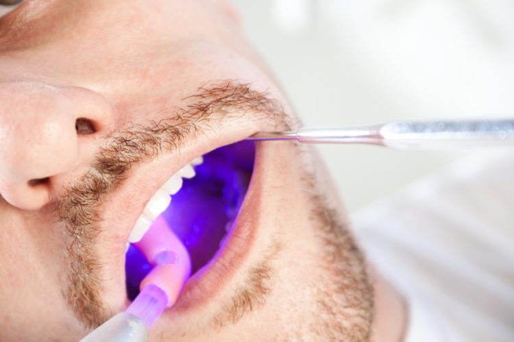 Advantages Of Laser Gum Treatment Nyc Advanced Periodontics